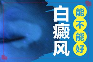 白癲風(fēng)能嗎,治療時應(yīng)該注意什么(治療怎么才好)