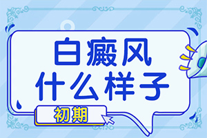 白廣癲瘋圖片[做什么檢查好呢]白癲病初期癥的圖片