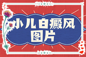 白癩風(fēng)可以治療好嗎？有什么土方法嗎（診療白斑這些是關(guān)鍵）