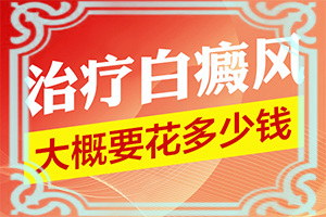 白癜風(fēng)治療大概需要多長時間,應(yīng)該做些(能用哪種方法治療)