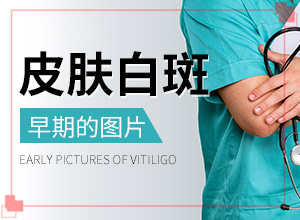 長白殿風(fēng)是什么原因-男生私密處出現(xiàn)白斑是怎么回事