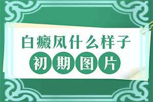 頭皮長(zhǎng)了白班[常見(jiàn)診斷方式]白殿風(fēng)的癥狀