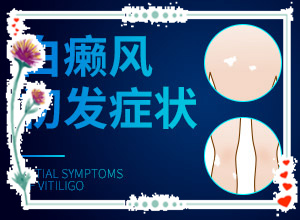 白點癲風(fēng)是什么原因-小孩消化不良臉上長白斑怎么辦