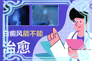 [需要注意什么]白癩風用什么藥治療