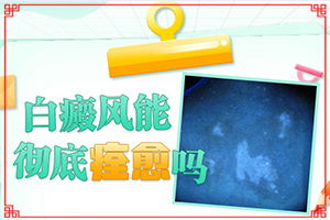 白瘕風(fēng)是怎么引起的,病因有什么(患發(fā)是什么原因)
