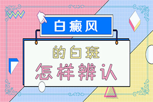 白顛瘋的癥狀,如何診斷白癜風癥狀(不同時期是什么癥狀)