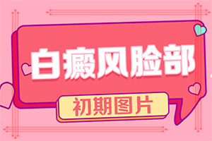 8歲男孩兒手上有白斑怎么回事,發(fā)病的原因是什么(是怎么引起的)