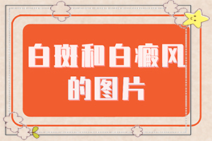 [如何較快治療白斑]肢端白斑最好的治療方法