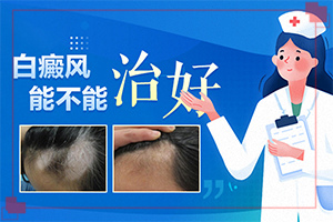 白殿風(fēng)怎么引起的,哪些因素影響(常見(jiàn)誘因有哪些)