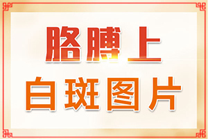 白點(diǎn)癲風(fēng)早期癥狀圖片[診斷方法是什么]白顛的癥狀圖片