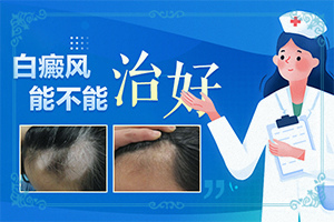 嘴角有白斑不痛不癢是怎么回事,發(fā)作原因是哪些(具體的誘因有哪些)