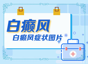 白癲瘋是什么癥狀？[白斑病情有哪些癥狀]手指上白癲風(fēng)