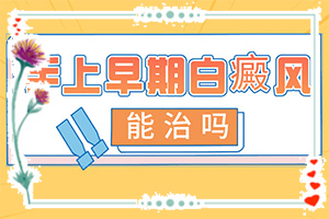 什么是白癜風-一般會出現(xiàn)在哪些部位