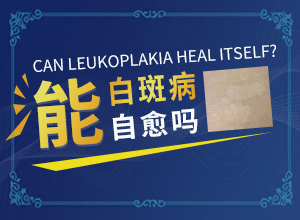 白癲風的治療[能做些什么來輔助]指端白癲風怎么治療更好