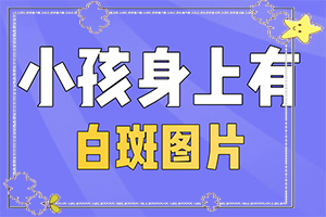 白瘋癲初期癥狀圖片,有哪些癥狀表明出現(xiàn)嚴(yán)重情況呢(光滑的白斑是嗎)