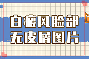 白癩風(fēng)的圖片[如何辨別]白廣癲瘋圖片