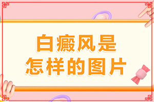 白點癲風(fēng)哪里治療好[科學(xué)正確治療方法]兒童白癲風(fēng)可以治愈嗎