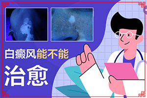 電焊烤的額頭有白斑塊怎么會事，有處理辦法嗎，（需要怎么治療）