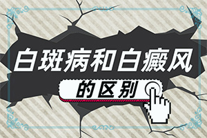 免疫力低下會出現(xiàn)白斑嗎-3歲男孩臉上長白斑是怎么回事