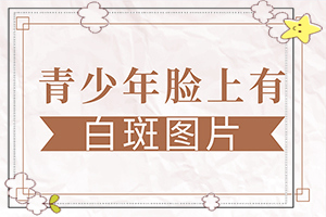 白斑和白點(diǎn)癲風(fēng)的區(qū)別,癥狀表現(xiàn)特點(diǎn)是(有什么不同之處)