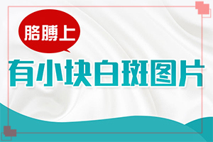 白點癲風(fēng)怎樣治[如何調(diào)節(jié)控制]治療兒童白斑需要多少錢