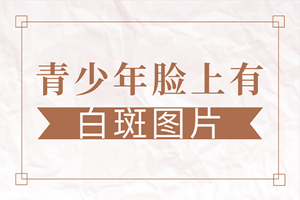 [熱門討論]青少年患上白癜風(fēng)的原因有哪些-是什么讓青少年也患上白癜風(fēng)疾病