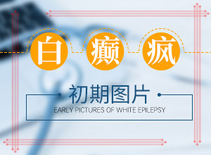 為什么會長白班-出現(xiàn)的原因是什么