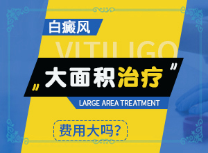 哪個醫(yī)院治療白癜風(fēng)好,為何不易治(診治白斑什么好)