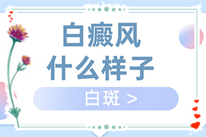 白顛瘋癥怎么治療最好[怎么治療比較合適]兒童白癩癜風(fēng)能治好嗎