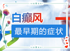白點(diǎn)癲風(fēng)的圖[癥狀表現(xiàn)特點(diǎn)是什么]手腕手指白班