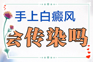白斑和白顛瘋有區(qū)別嗎[都有哪些表現(xiàn)癥狀呢]額頭出現(xiàn)白班