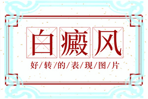 白巔峰是怎樣造成的,常見病因有哪些(白斑誘發(fā)什么有關(guān))