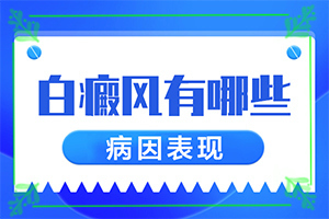 哪家可以治白癲[什么方法治療]白癲治療費用是多少