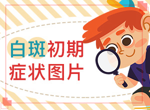 嬰兒出濕疹后臉上長了好多白斑,什么因素能導致(白斑病發(fā)的原因)