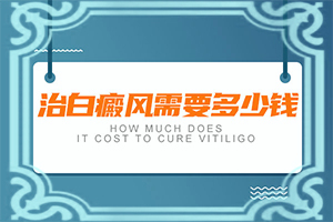 早期白癩風(fēng)是小白點嗎[幾個基本表現(xiàn)]白點癲風(fēng)和白斑的區(qū)別