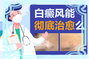 白瘋癲是怎么產(chǎn)生的-嬰幼兒胳膊上有白斑怎么回事。