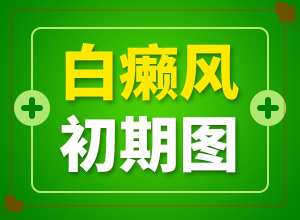 白癲早期咋冶療[怎么控制才好]手指上長(zhǎng)白顛瘋?cè)绾沃委?></p>
<section style=