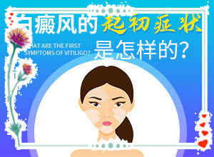 臉上皮膚過敏留下白斑什么原因,什么原因會(huì)誘發(fā)(原因是什么)