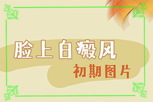 長白班是什么原因-四歲小孩臉上有白斑是什么原因