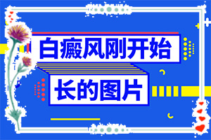 白癩風(fēng)如何引起的-十歲女孩背上有小白斑怎么回事