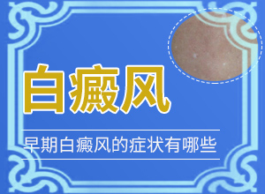2歲寶寶臉上有白斑，膚色不均勻涂什么藥（為什么會(huì)好治）