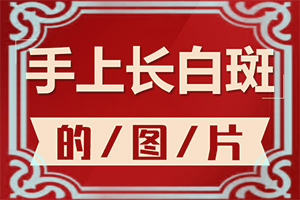 白班怎樣治療,需要什么樣的治療(怎么更好治療)