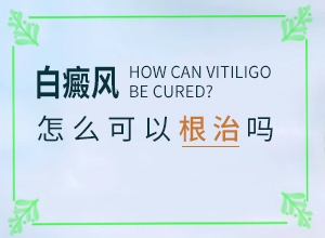 向癜風能治好嗎,盲點是什么(如何調(diào)節(jié)控制)