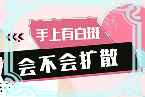 白癲治療最佳醫(yī)院[應(yīng)該怎么治療和防護]白顛瘋病初期能好嗎?