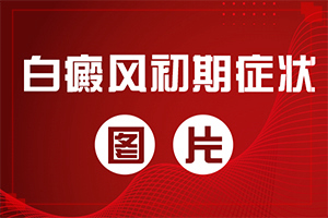白癲瘋手上能治愈嗎[治療該怎么做]白顛瘋可以治嗎