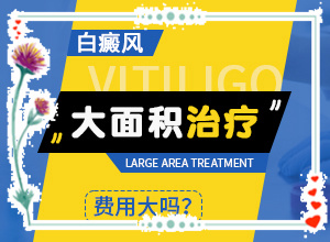 遺傳白巔峰治療法[能盡快治療好嗎]治療白癲瘋大約多少錢