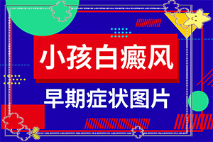 [嚴(yán)重還能治好嗎手上一年多白斑怎么治呢