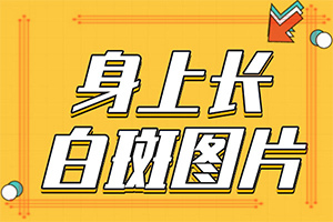 白癩風(fēng)怎么造成的-嬰兒屁股上有塊白斑是怎么回事