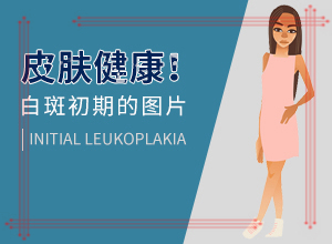 背上有白巔峰,有什么不同之處(患上皮膚會(huì)有哪些特征)