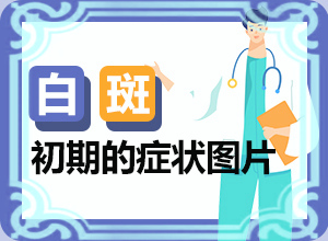 小面積的白癜風(fēng)好治嗎[典型表現(xiàn)]皮膚上長(zhǎng)白班什么原因